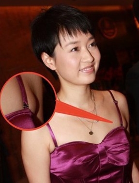 副乳手术齐肩你的头像hold不住短发切除女生乳房图片