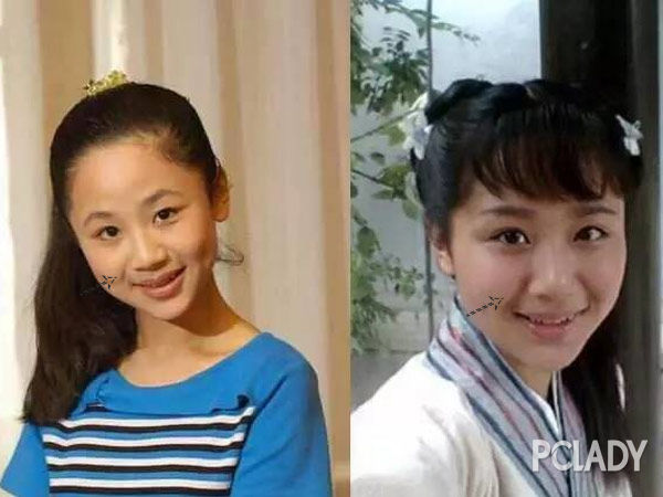 杨紫求助网友怎么去法令纹 看完这一篇她就懂了 杨紫求助网友怎么去法令纹 看完这一篇她就懂了