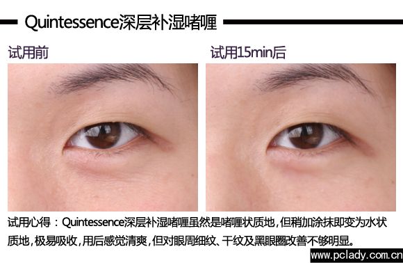 时尚盛典评测第32期 8款医用术后舒缓谁最呵护？