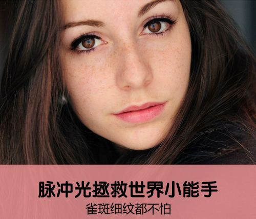雀斑细纹都不怕 脉冲光拯救世界